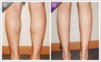 瘦小腿的方法