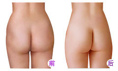 肌肉型小腿怎样瘦腿