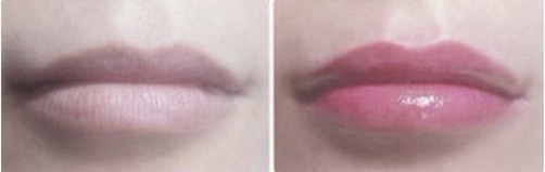 爱贝芙丰唇的效果怎样