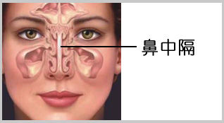 歪鼻整形手术恢复时间及注意事项