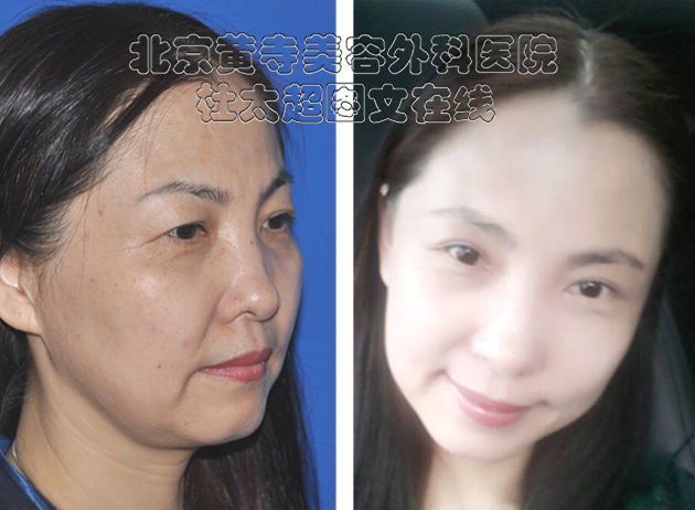 北京黄寺整形美容杜太超