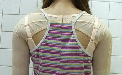 实图直击：网友手臂抽脂经历 