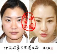 北京黄寺整形美容杜太超