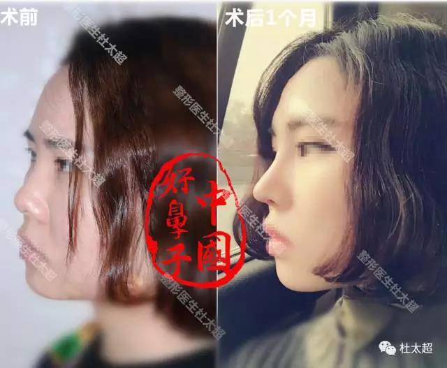 1494916534173104.jpg 微信图片_20170516142832.jpg