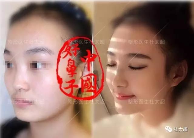 1494916522392479.jpg 微信图片_20170516142823.jpg