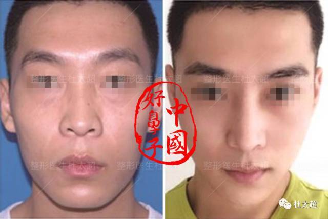 1497080231160482.jpg 微信图片_20170610153519.jpg