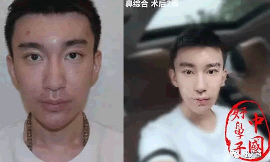 1498123946961988.jpg blob.jpg