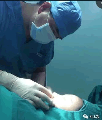 1498304737531846.jpg blob.jpg