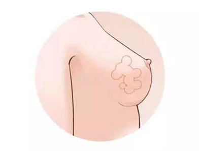 1498304683938093.jpg blob.jpg