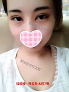 北京黄寺整形美容杜太超